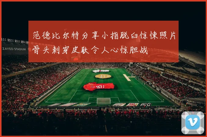范德比尔特分享小指脱臼惊悚照片骨头刺穿皮肤令人心惊胆战